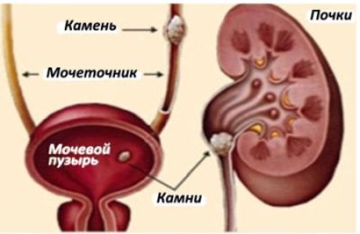 Моча кирпичного цвета у женщин причины